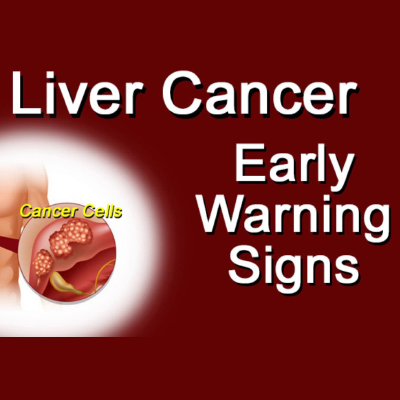 liver cancer doctors